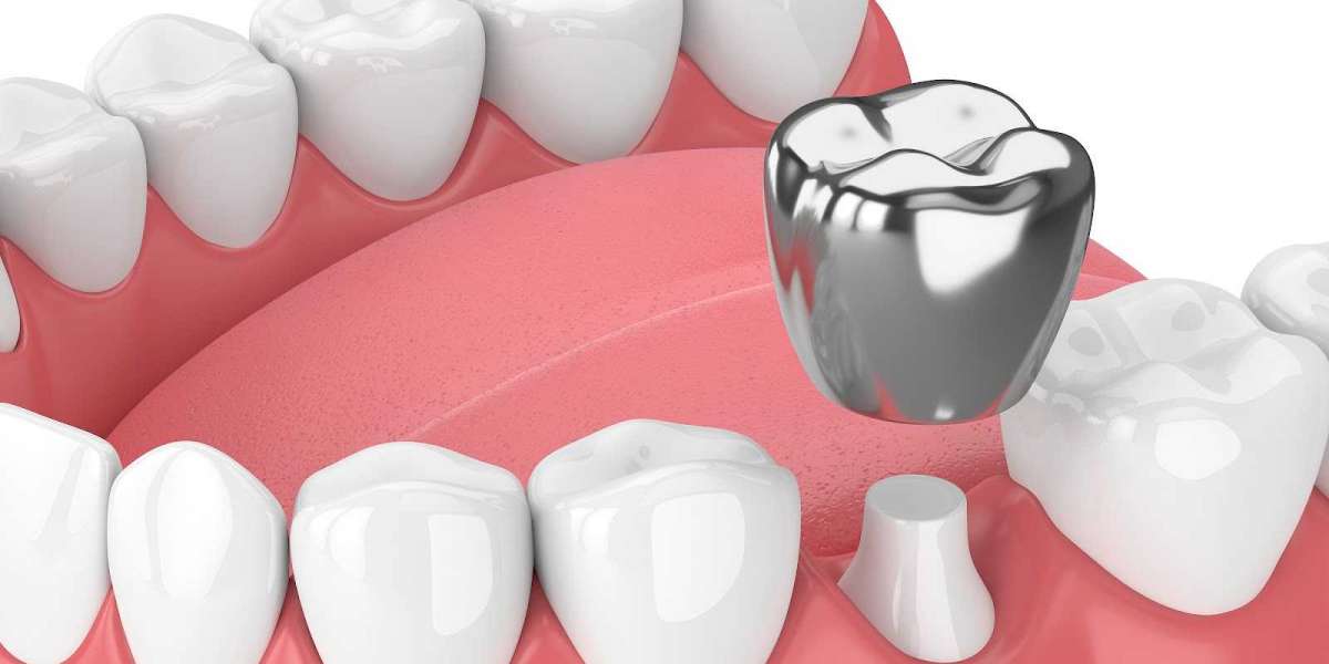 Fluoride Treatment for Adults Protecting Dental Health at Every Age In Houston