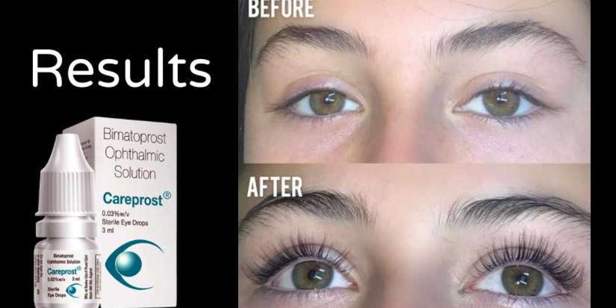 How to Grow Long Eyelashes Using Careprost Eyelash Serum