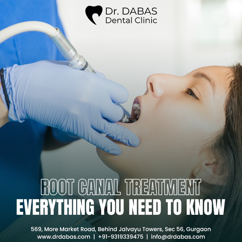 Root canal treatment- Everything you need to know - Dr. Dabas