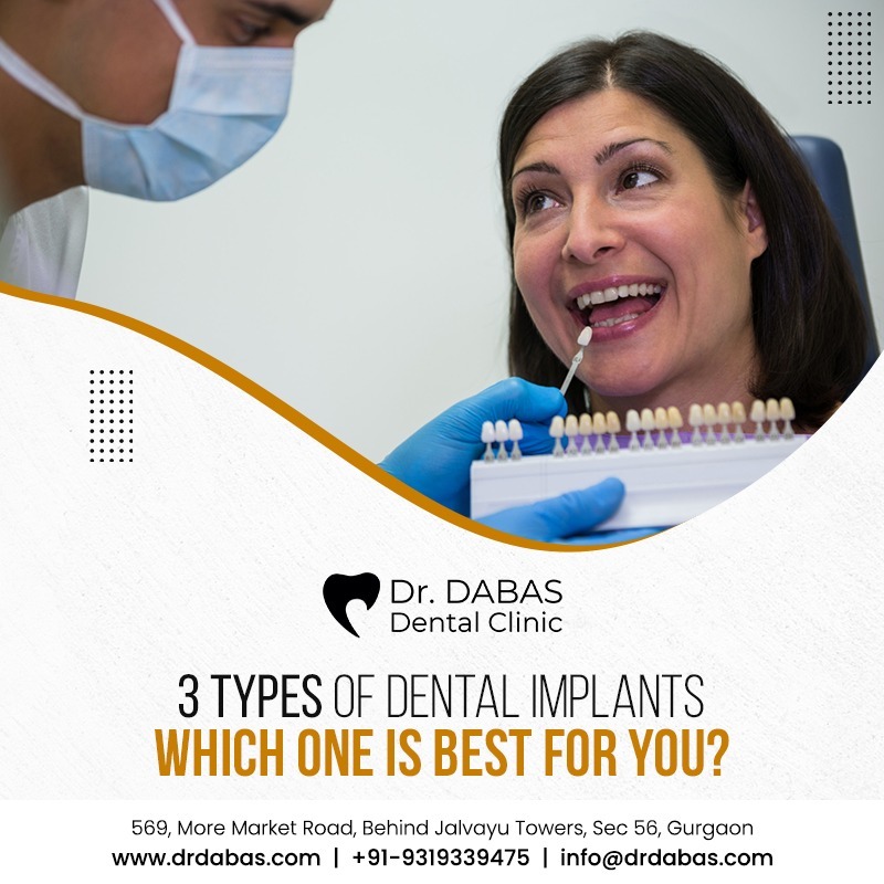 3 Types of Dental Implants Which One Is Best for You? - Dr. Dabas