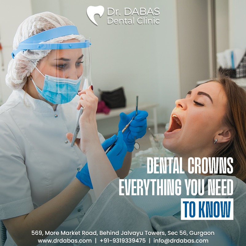 Dental Crowns: Everything You Need To Know - Dr. Dabas