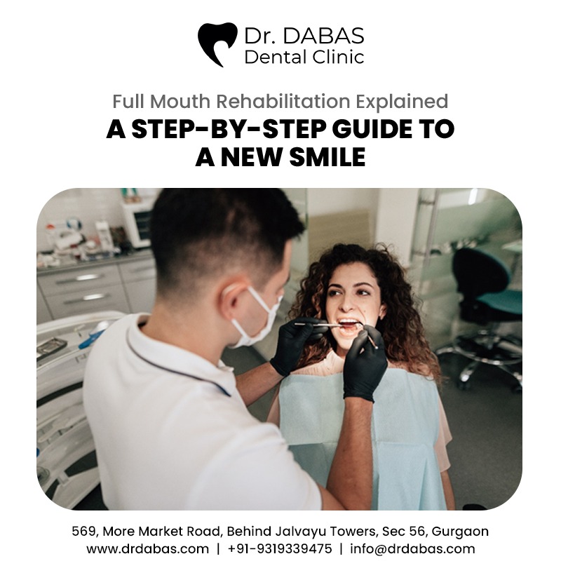 Full Mouth Rehabilitation Explained: A Step-by-Step Guide to a New Smile