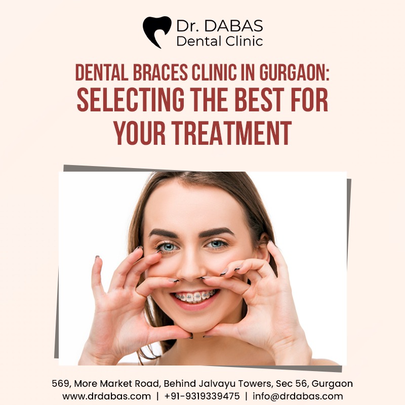 Dеntal Bracеs Clinic in Gurgaon: Selecting thе Bеst for Your Treatment